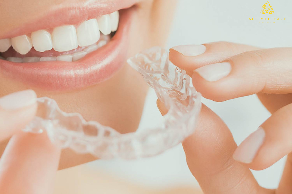 How Clear Aligners Can Improve Your Oral Health